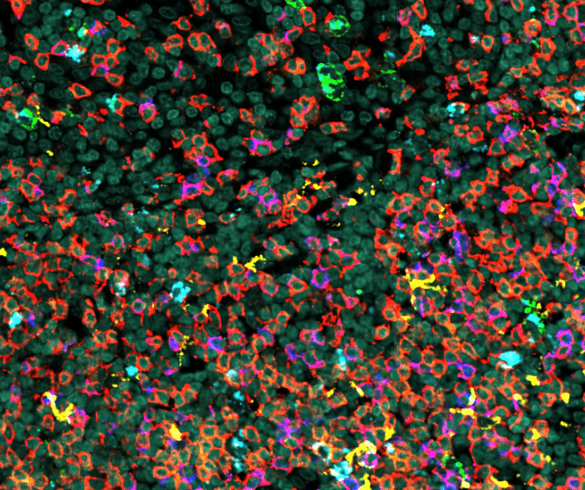 Spatial transcriptomic image analysis for Tonsil project